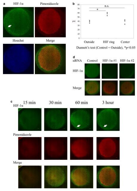 FIGURE 2 Unique HIF-1α distribution in the hypoperfusion model, 