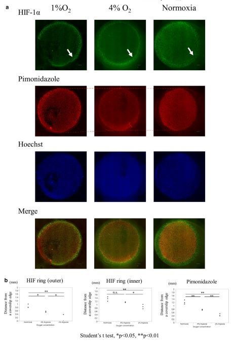 FIGURE 3 HIF-1α distribution under different homogenous oxygen tensions incubation. (a) ICC of HIF of HK-2 cells covered with a round  15 mm coverslip under different homogenous oxygen tensions, incubated for 3 h