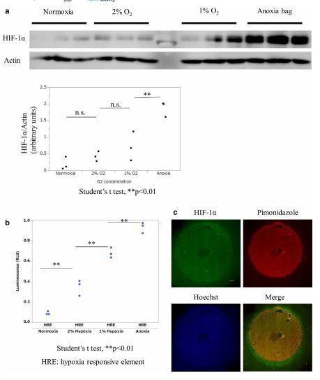 FIGURE 5 HIF-1α accumulation in homogenous oxygen tension. (a) Quantitative analysis of HIF-1α protein in different homogenous oxygen  tensions by western blotting.