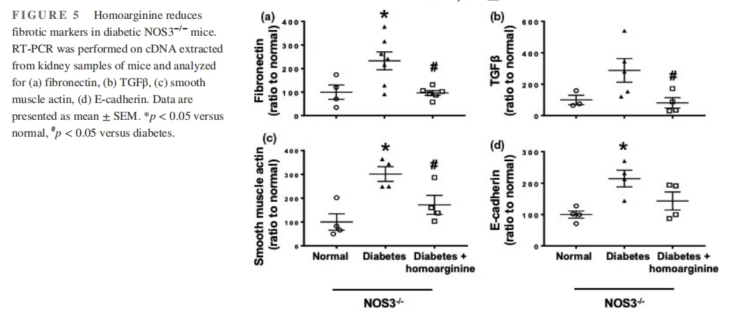 Homoarginine reduces fibrotic markers in diabetic NOS3−/− mice. RT-PCR was performed on cDNA extracted from kidney samples of mice and analyzed for (a) fibronectin, (b) TGFβ, (c) smooth muscle actin, (d) E-cadherin. Data are presented as mean ± SEM. *p < 0.05 versus normal, #p < 0.05 versus diabetes. Homoarginine reduces fibrotic markers in diabetic NOS3−/− mice. RT-PCR was performed on cDNA extracted from kidney samples of mice and analyzed for (a) fibronectin, (b) TGFβ, (c) smooth muscle actin, (d) E-cadherin. Data are presented as mean ± SEM. *p < 0.05 versus normal, #p < 0.05 versus diabetes.