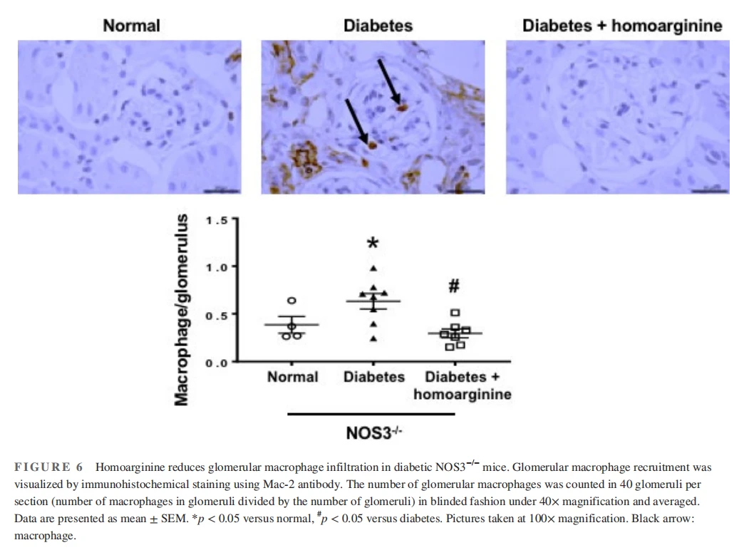 Homoarginine reduces glomerular macrophage infiltration in diabetic NOS3−/− mice. Glomerular macrophage recruitment was visualized by immunohistochemical staining using Mac-2 antibody. The number of glomerular macrophages was counted in 40 glomeruli per section (number of macrophages in glomeruli divided by the number of glomeruli) in blinded fashion under 40× magnification and averaged. Data are presented as mean ± SEM. *p < 0.05 versus normal, #p < 0.05 versus diabetes. Pictures taken at 100× magnification. Black arrow: macrophage Homoarginine reduces glomerular macrophage infiltration in diabetic NOS3−/− mice. Glomerular macrophage recruitment was visualized by immunohistochemical staining using Mac-2 antibody. The number of glomerular macrophages was counted in 40 glomeruli per section (number of macrophages in glomeruli divided by the number of glomeruli) in blinded fashion under 40× magnification and averaged. Data are presented as mean ± SEM. *p < 0.05 versus normal, #p < 0.05 versus diabetes. Pictures taken at 100× magnification. Black arrow: macrophage
