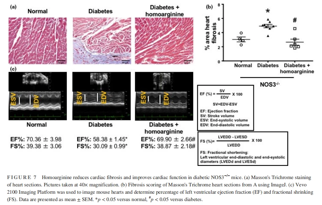 Homoarginine reduces cardiac fibrosis and improves cardiac function in diabetic NOS3−/− mice. (a) Masson's Trichrome staining of heart sections. Pictures taken at 40× magnification. (b) Fibrosis scoring of Masson's Trichrome heart sections from A using ImageJ. (c) Vevo 2100 Imaging Platform was used to image mouse hearts and determine percentage of left ventricular ejection fraction (EF) and fractional shrinking (FS). Data are presented as mean ± SEM. *p < 0.05 versus normal, #p < 0.05 versus diabetes. Homoarginine reduces cardiac fibrosis and improves cardiac function in diabetic NOS3−/− mice. (a) Masson's Trichrome staining of heart sections. Pictures taken at 40× magnification. (b) Fibrosis scoring of Masson's Trichrome heart sections from A using ImageJ. (c) Vevo 2100 Imaging Platform was used to image mouse hearts and determine percentage of left ventricular ejection fraction (EF) and fractional shrinking (FS). Data are presented as mean ± SEM. *p < 0.05 versus normal, #p < 0.05 versus diabetes.